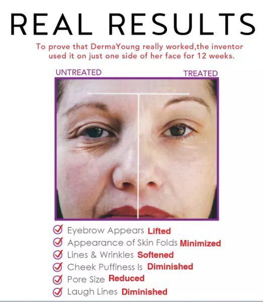 Вакуумный очиститель пор Derma Young 1712275727 фото