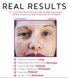 Вакуумный очиститель пор Derma Young 1712275727 фото 4