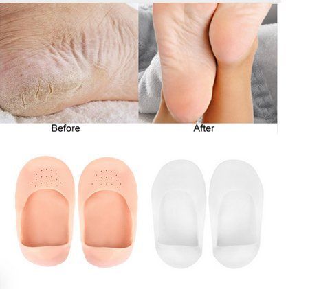Силиконовые носки увлажняющие носочки против трения стопы ANTI-CRACK SILICONE SOCKS. Бежевый TV210 фото
