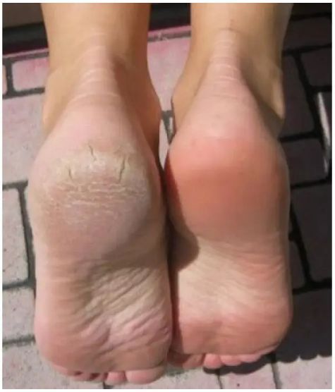 Пемза электрическая беспроводная c фрезером для ухода за ногами 4-в-1 socks & foot BR00077 VEN77 фото