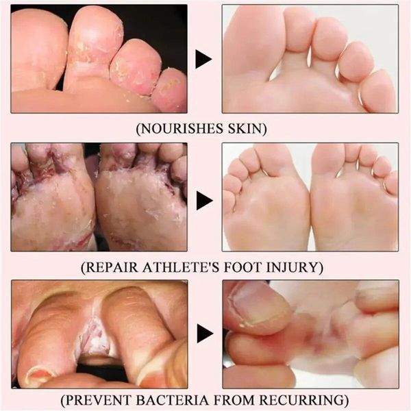 Засіб для догляду за ногами 12 Piece Miracle Foot Repair VEN0266 фото