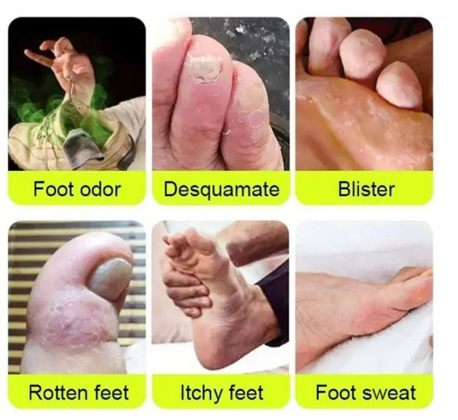 Засіб для догляду за ногами 12 Piece Miracle Foot Repair VEN0266 фото