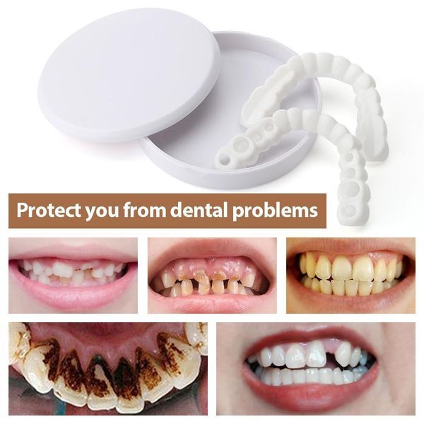 Вініри SnapOn Smile Veneers для зубів сніп він змайл 2 ЧЕЛЮСТІ VEN286B фото
